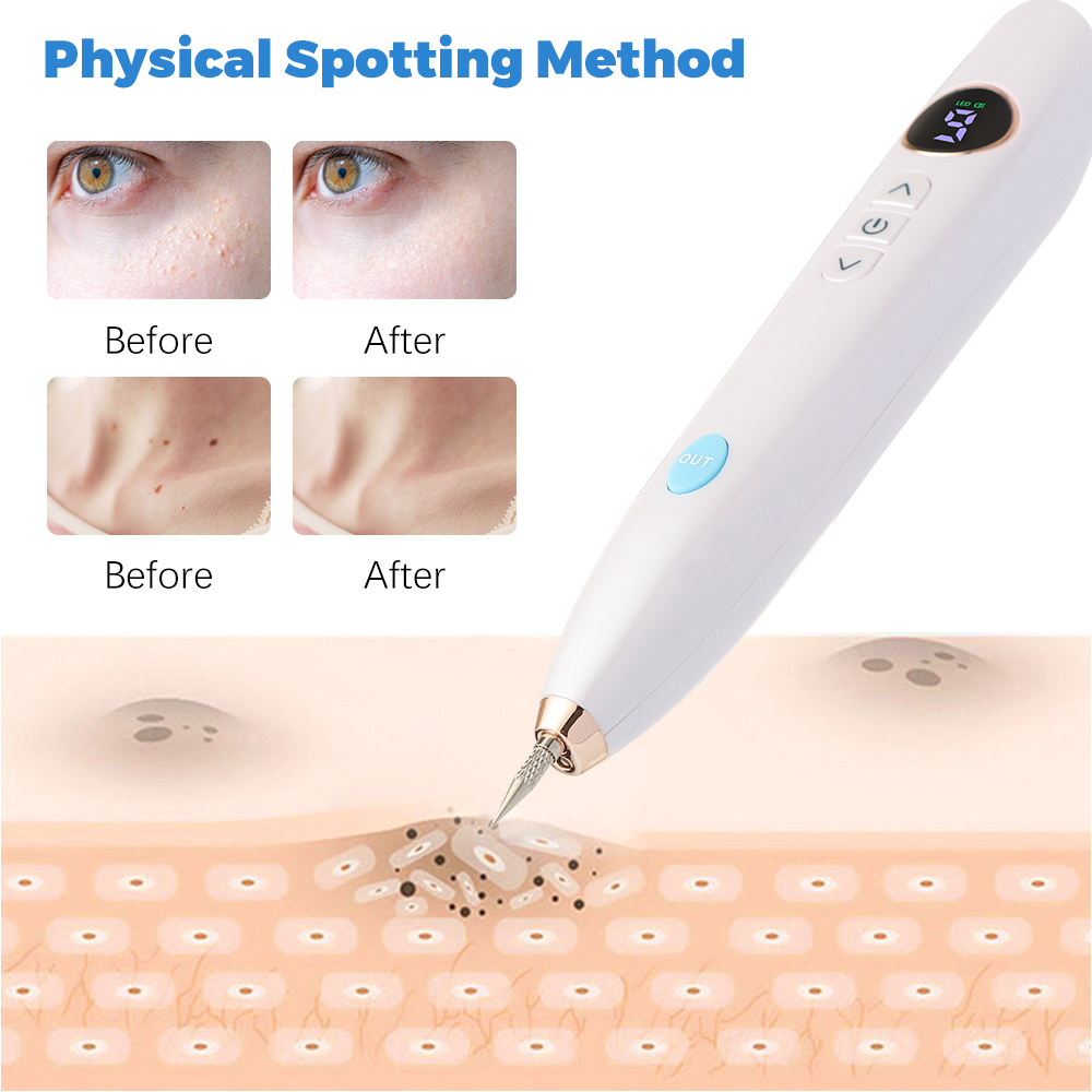 Plasma Mole and Skin Tag Removal Pen