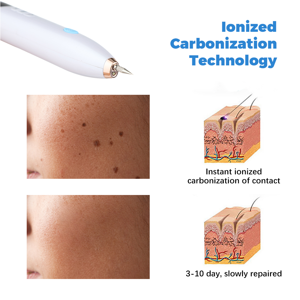 Plasma Mole and Skin Tag Removal Pen
